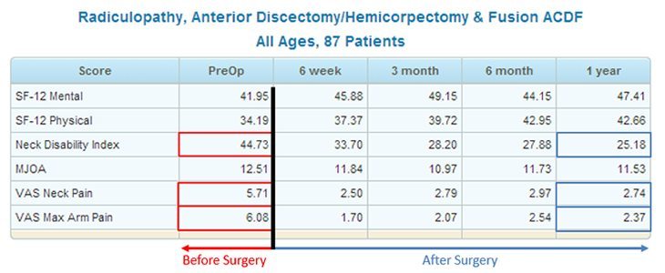 Spine Center Discectomy Treatment Results